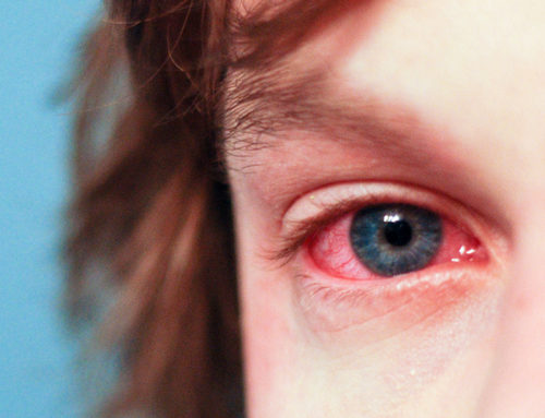 How Our Eyes Respond To Irritants